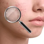 SkinScan AI: Face & Mole Check icon