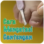 Cara Mengatasi Cantengan icon