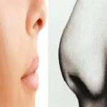 طرق تصغير الأنف icon