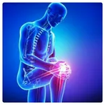 Osteoarthritis icon