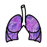 Lung Cancer Stage icon