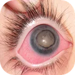 Eye Diseases icon
