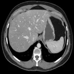 abdominal CT: annotated slices icon