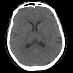 Brain CT : annotated slices icon