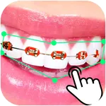 Braces Booth Stickers photo ed icon