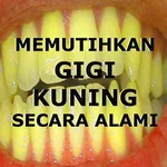Cara Memutihkan Gigi Secara Al icon