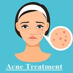 Acne Treatment icon