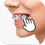 Braces on teeth: Photo editor icon