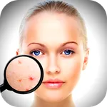 Face Enhancer: Blemish Remover icon