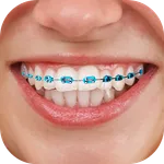 Braces : Add Braces On Photo icon