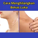 Cara Menghilangkan Bekas Luka icon