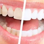 Teeth whitening resipes icon