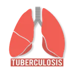 TB Treatment & Advice (Bisaya) icon