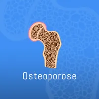 Osteoporose icon