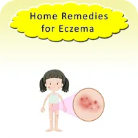 Home Remedies for Eczema icon