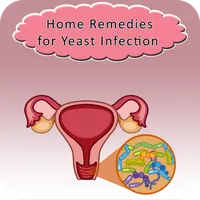 Home Remedies for Yeast Infect icon