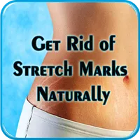 Get Rid of Stretch Marks Natur icon