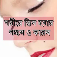 শরীরে তিল হওয়ার লক্ষন ও কারন icon