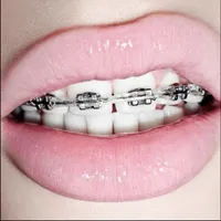 Dental Braces icon