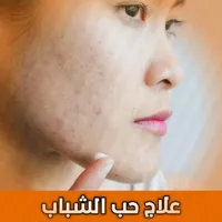 وصفات علاج حب الشباب بسرعة icon