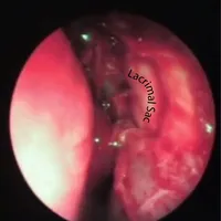 ENTSURGERY icon