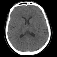 Brain CT : annotated slices icon