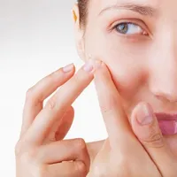 Remove Acne icon