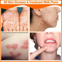 All Skin Diseases and Treatmen icon