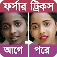৫ দিনে ফর্সা হন | নারী-পুরুষ উ icon