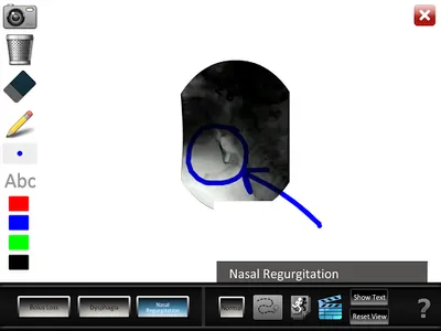 Swallowing Oral screenshot 3