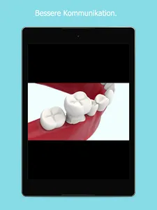 DentXplain screenshot 13