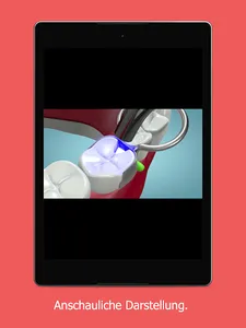 DentXplain screenshot 14