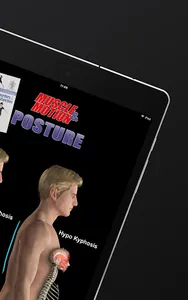 Posture by Muscle & Motion screenshot 17