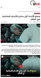 Hnews - أشنيوز screenshot 6
