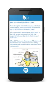 CSF Leak Companion App screenshot 2