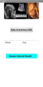 Growth Interval Calculator screenshot 0