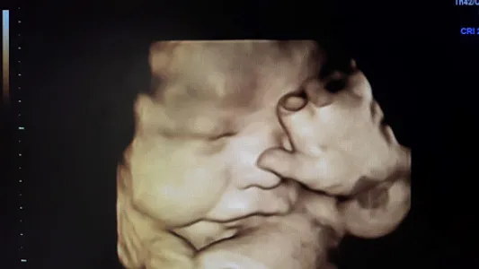 Bellybaloo screenshot 2