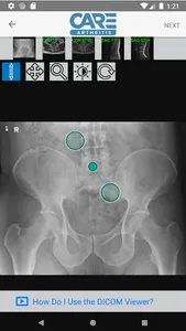 Care Arthritis Mobile screenshot 1