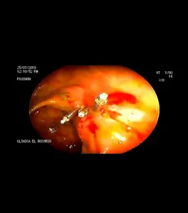 Gastro y Endo Oncologica RA 2 screenshot 0