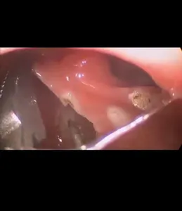 Gastro y Endo Oncologica RA 2 screenshot 1