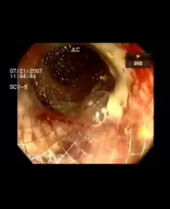 Gastro y Endo Oncologica RA 2 screenshot 2