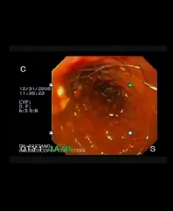 Gastro y Endo Oncologica RA 2 screenshot 3