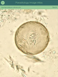 Parasitology Image Atlas screenshot 11