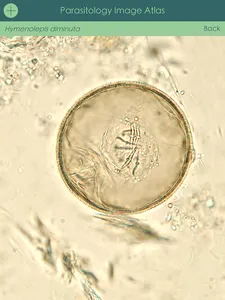Parasitology Image Atlas screenshot 6