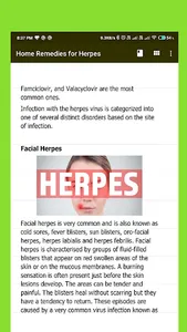 Home Remedies for Herpes screenshot 3
