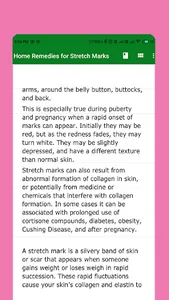 Home Remedies for Stretch Mark screenshot 7