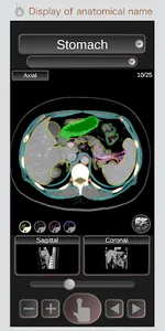 CT Passport Abdomen / sectiona screenshot 0