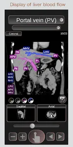 CT Passport Abdomen / sectiona screenshot 1