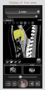 CT Passport Abdomen / sectiona screenshot 2