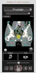 CT Passport Abdomen / sectiona screenshot 3